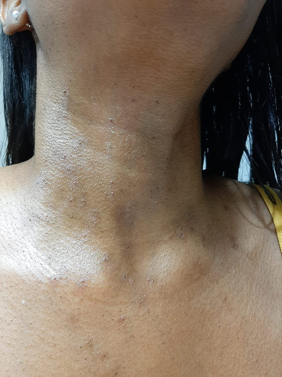 Lumiva™ Kit dépilatoire 1+1