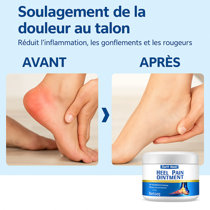 Crème Apaisante Neuropathique | Soulage les douleurs nerveuses et les engourdissements en 5 minutes!