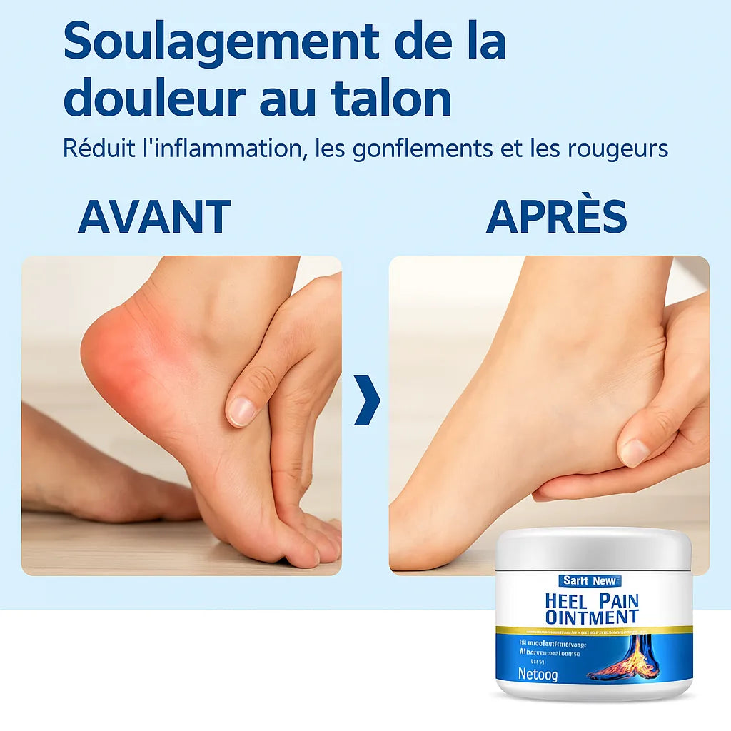 Crème Apaisante Neuropathique | Soulage les douleurs nerveuses et les engourdissements en 5 minutes! BK
